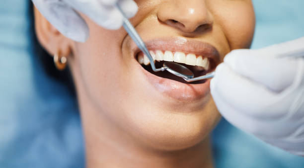 Best Emergency Root Canal Treatment in Custer, SD
