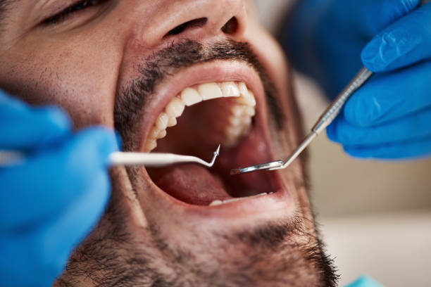 Best Emergency Treatment for Toothache in Custer, SD