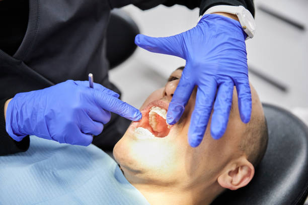 Best Emergency Wisdom Teeth Removal in Custer, SD