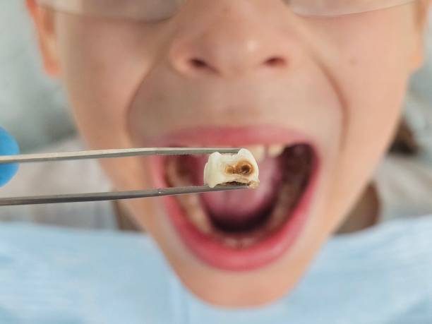 Best After-Hours Emergency Dentist in Custer, SD